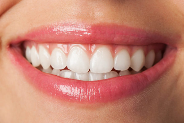 Zahnarzt Hennef - Zahnfleischbehandlung